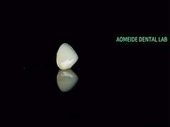 Ponte da Coroa de Cerâmica