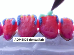 Força Estética natural Coroa de zircônio sólido Perfeito para dentes únicos ou múltiplos