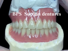 Dentaduras de sucção BPS como uma solução eficaz de dentaduras removíveis para maior conforto e estabilidade