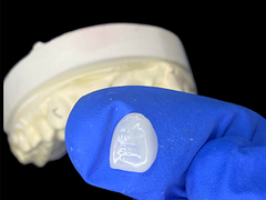 IPS e.max Veneers para incisores na tonalidade A1 Estética natural para sorrisos perfeitos