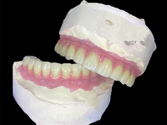 Implantes dentários revolucionários para um sorriso completo com estabilidade e conforto