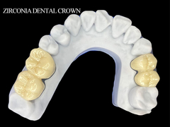 Coroa dental de zircônio para molares