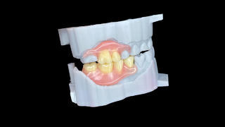Próteses flexíveis personalizadas com ajuste natural e conforto duradouro.