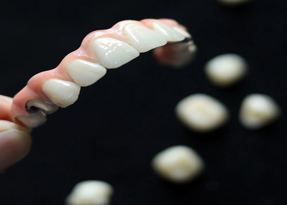 comprar Solução Estética Implante Dental Ponte da Coroa Para Adultos Substituindo Dentes Faltantes online manufacture