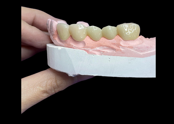 comprar Todas as coroas e pontes de cerâmica projetadas para uma estética superior, durabilidade e ajuste natural para uma confiança duradoura. online manufacture
