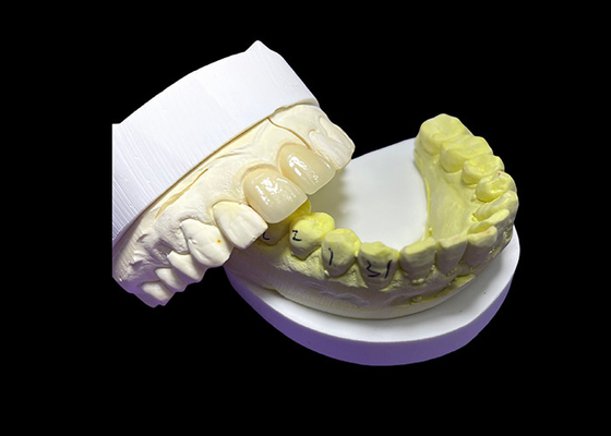 comprar Coroas e pontes de cerâmica personalizadas para um ajuste perfeito e desempenho duradouro online manufacture
