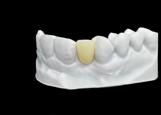 comprar Resistência à ruptura Coroa dental de zircônio com força e translucidez excepcionais online manufacture