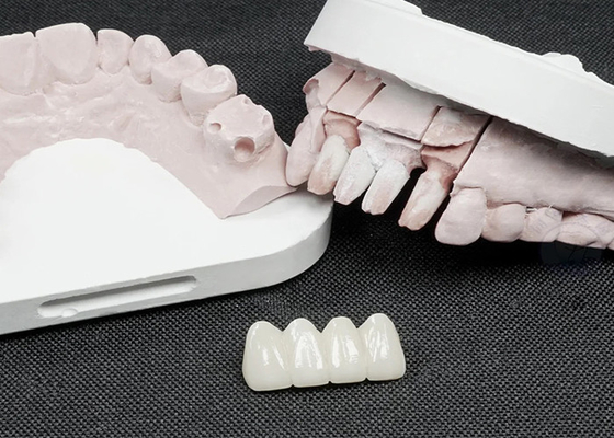 comprar Coroas dentárias de zircônio premium para resistência superior e estética natural online manufacture