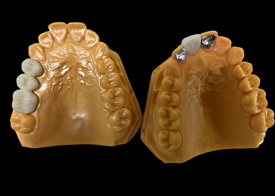 comprar Porcelana de translucidez moderada fundida ao metal PFM Crown, PFM Ceramic Crown online manufacture