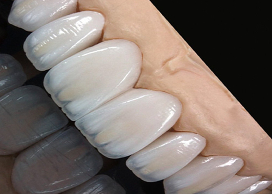 comprar Ponte de coroa de cerâmica translúcida resistente a manchas, perfeita para um sorriso natural online manufacture