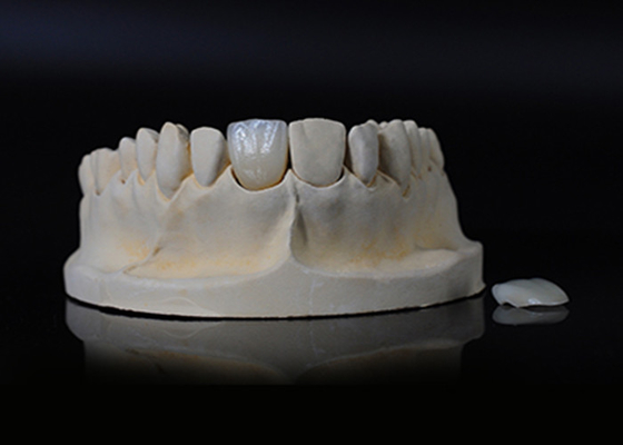 comprar Porcelana translúcida Emax Veneer para excelente ajuste / estética natural online manufacture