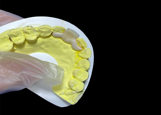comprar Coroa de cerâmica dentária de aparência natural HPP ponte cerâmica ligada fácil limpeza online manufacture