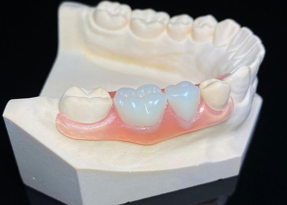 comprar OEM Dentes Invisíveis Removíveis Prótese Dental Parcial de Resina Acrílica Personalizada online manufacture