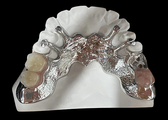 comprar Dentadura parcial removível de fundição personalizável com resina acrílica / design de base metálica online manufacture