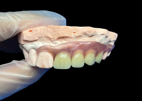 comprar Dentaduras parciais flexíveis invisíveis para conforto de ajuste seguro e estética natural online manufacture