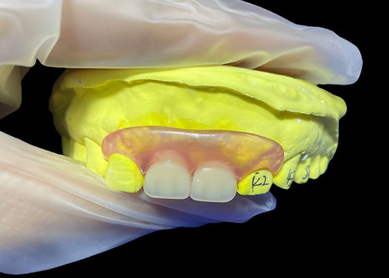 comprar Adaptado, seguro, invisível, flexível, substituto de dentadura parital para mastigar e falar confortavelmente. online manufacture