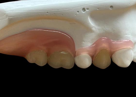 comprar Dentadura flexível invisível ajustável: adequada para mastigar confortável e falar com durabilidade variável online manufacture