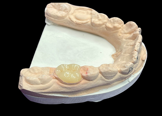 comprar Incrustação de cerâmica dentária suave personalizada para reparação de dentes sem costura resistente à coloração e estética natural online manufacture
