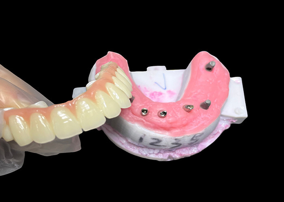 comprar Implante suportado Prótese de arco completo Implante dentário fixo Ponte de coroa cerâmica online manufacture