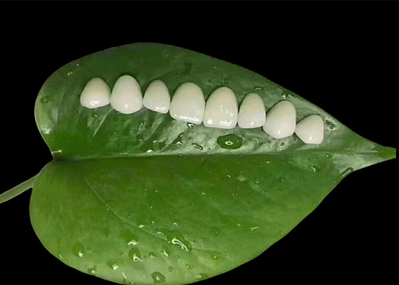 comprar Minima preparação Veneer de porcelana EMAX para tratamento cosmético dentário online manufacture