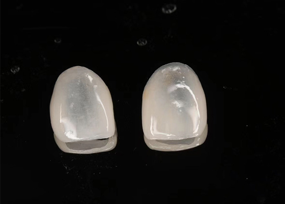 comprar Restauração Estética Emax Veneers Cerâmicos Translucidez com superfície polida online manufacture