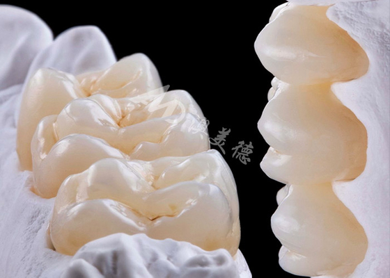 comprar Coroa dentária de zircônio de alta resistência para substituição de dentes únicos ou múltiplos online manufacture