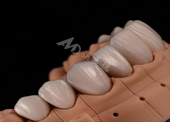 comprar Força Natural Estética Dentes Coroas de zircônia para resistência de chip de ajuste preciso online manufacture