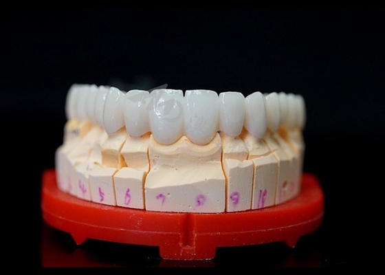 comprar Coroas de zircônio com ajuste preciso, coroas de zircônio altamente biocompativeis para dentes. online manufacture