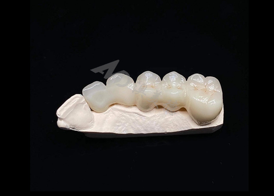 comprar Translucidez Estética natural Coroa de zircônio sólido para dentes Resistente a quebra online manufacture