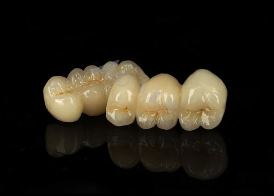 comprar Coroa de zircônio sólido resistente a manchas combinando excelente biocompatibilidade online manufacture
