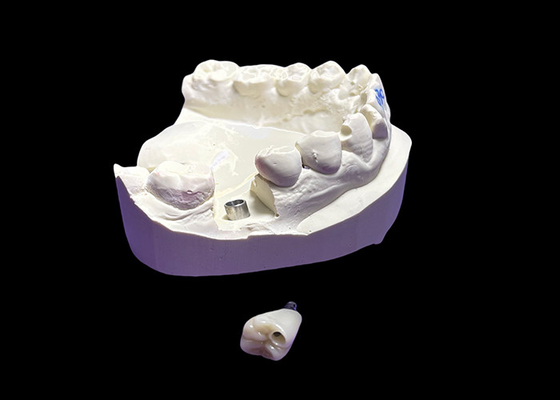 comprar Implante dentário com coroa de cerâmica e titânio online manufacture
