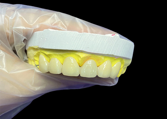 comprar Cosméticos Vita Classical Shade Coroas e pontes de cerâmica com aparência natural e opções personalizáveis online manufacture