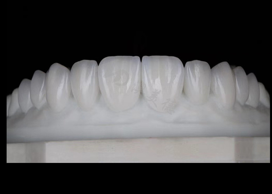 comprar Translucidez Natural Estética Coroas de Zirconia Excelente Biocompatibilidade E Força online manufacture