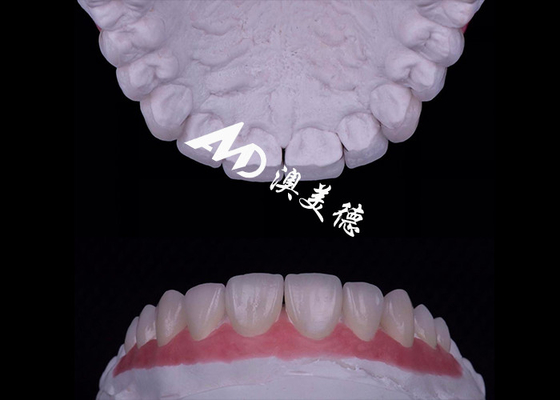 comprar Translúcido EMAX Finê de porcelana Resistente a manchas / resistência online manufacture