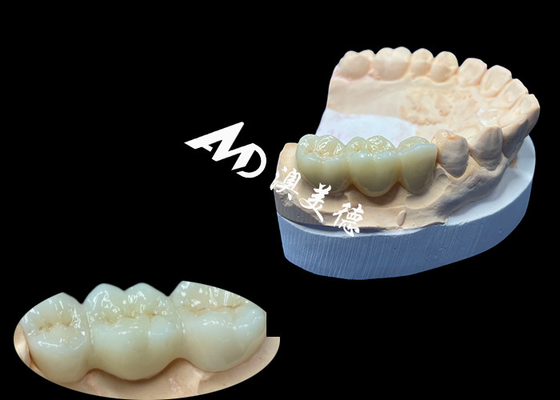comprar Cor natural de coroa dental de zircônio resistente a rachaduras para um sorriso perfeito do laboratório dentário da China online manufacture