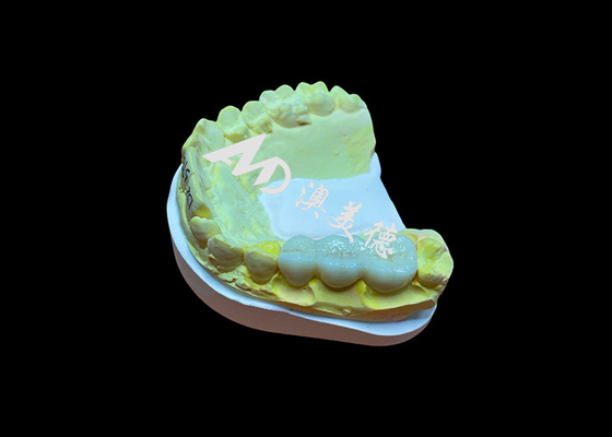 comprar Superfície lisa personalizada Coroa dentária de zircônio Alta biocompatibilidade Resistência a manchas online manufacture