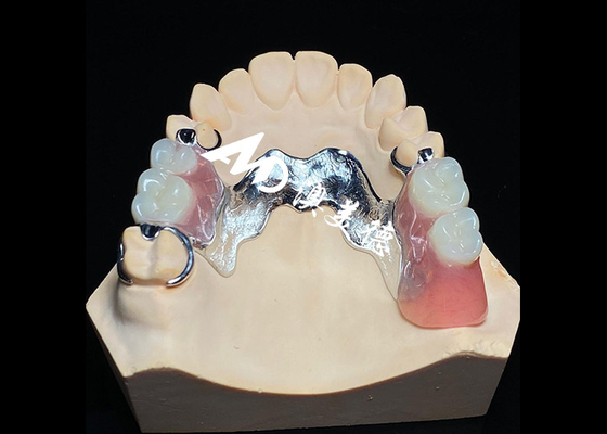 comprar Dentadura removível com estrutura de metal fundido para superior força e estabilidade com conforto duradouro online manufacture