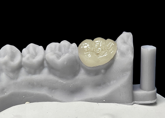 comprar Inlays de cerâmica dentária de ajuste preciso, Inlays de porcelana e Onlays aprovados pela FDA online manufacture