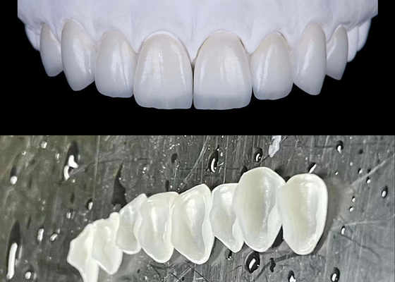comprar IPS emax Veneers de porcelana de prensagem alcançar um sorriso natural e radiante online manufacture