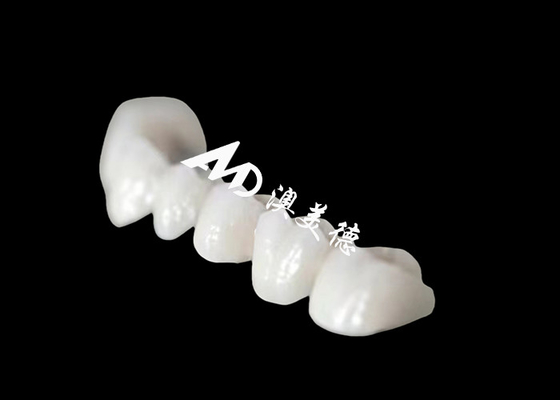 comprar Coroa dental de Zriconia de arco completo com aparência natural surpreendente online manufacture
