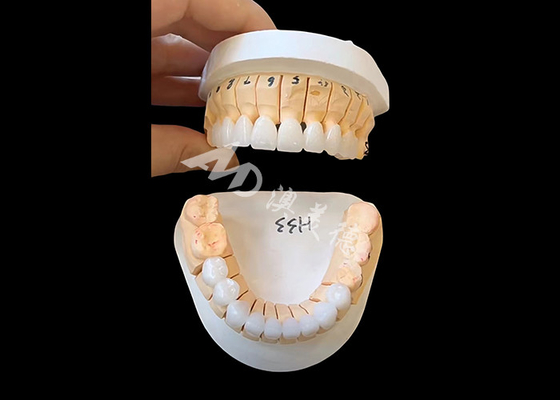 comprar Coroa dental de zircônio de translucidez melhorada para restaurações fixas de unidade única / múltipla online manufacture
