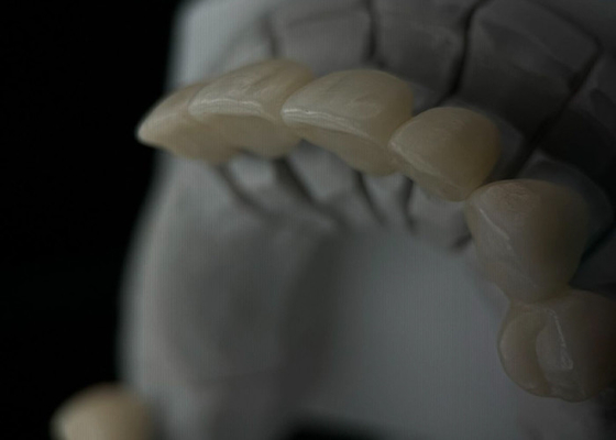 comprar Coroa de dente de zircônio monolítico com translucidez e resistência online manufacture
