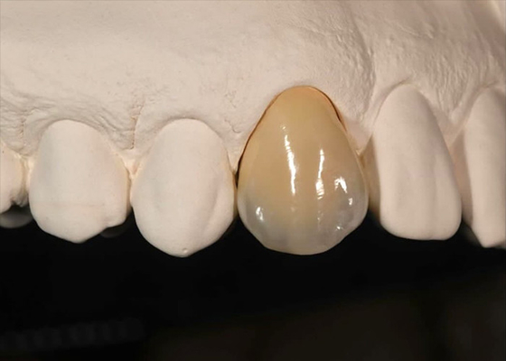 comprar Resistência à mancha Coroa de zircônio sólido para dentes da frente dentes posteriores online manufacture