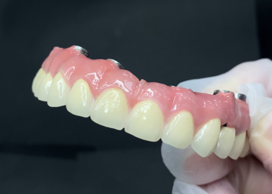 comprar Implantes Dentários Duráveis com Abutment de Titânio de Limpeza Fácil e Coroa de Circônio online manufacture
