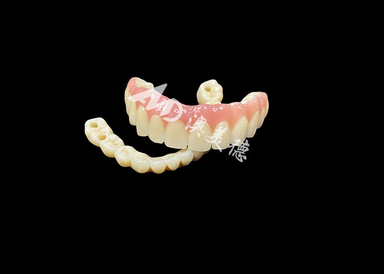 comprar Prótese dentária com implante de ponte A solução dentária definitiva para dentes faltantes online manufacture