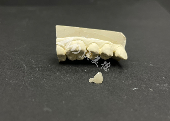 comprar Incrustação cerâmica Emax hipoalergénica resistente a manchas para reparação precisa de dentes danificados online manufacture