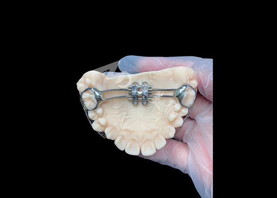 comprar MSE expansor palatino Aparelhos ortodônticos inovadores para alinhamento eficaz dos dentes online manufacture
