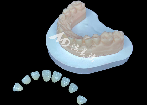 comprar IPS e.max Veneer Premium Solução Estética para Transformações de Sorriso Impressionantes online manufacture