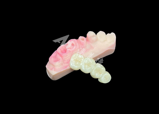 comprar Ponte de coroa de zircônio sólido superior para estética dental de aparência natural online manufacture