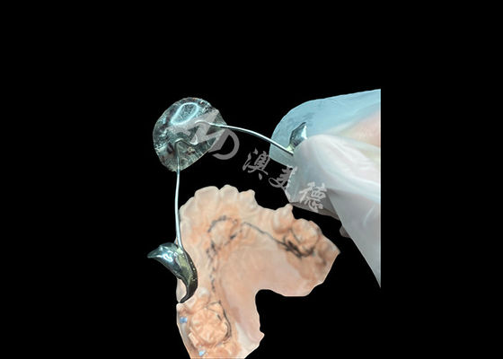 Bom preço Aplicativo de Nance Ortodôntico Solução Ótima de Estabilização e Manutenção de Espaço da Maxilar on-line